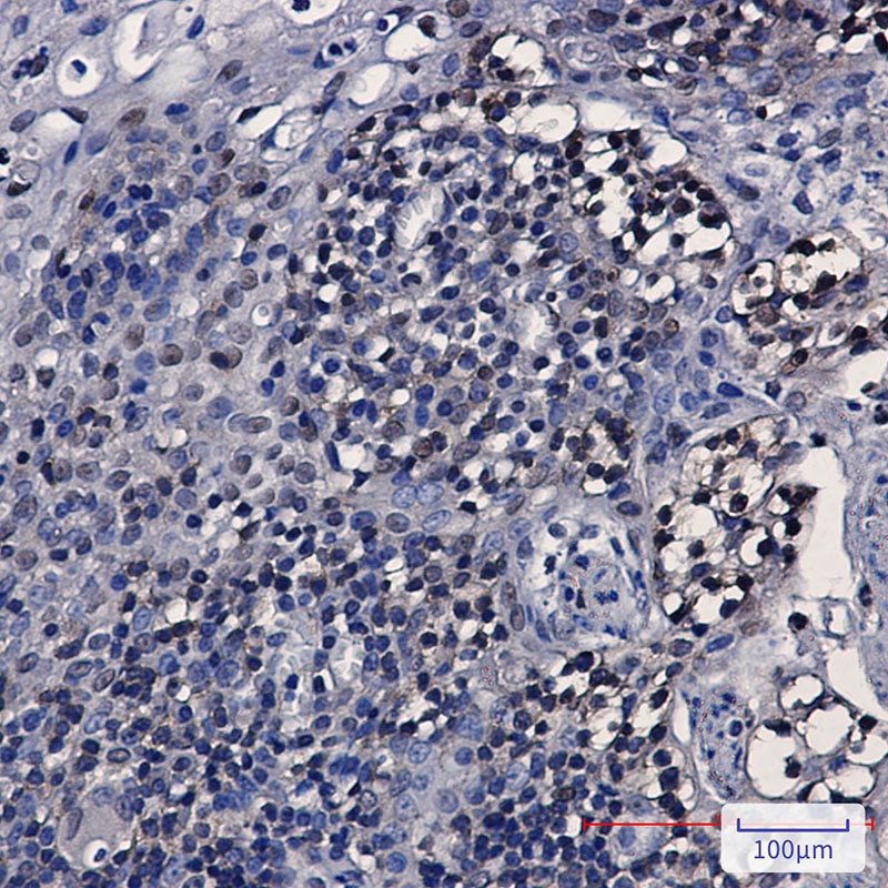 hnRNP K Rabbit mAb