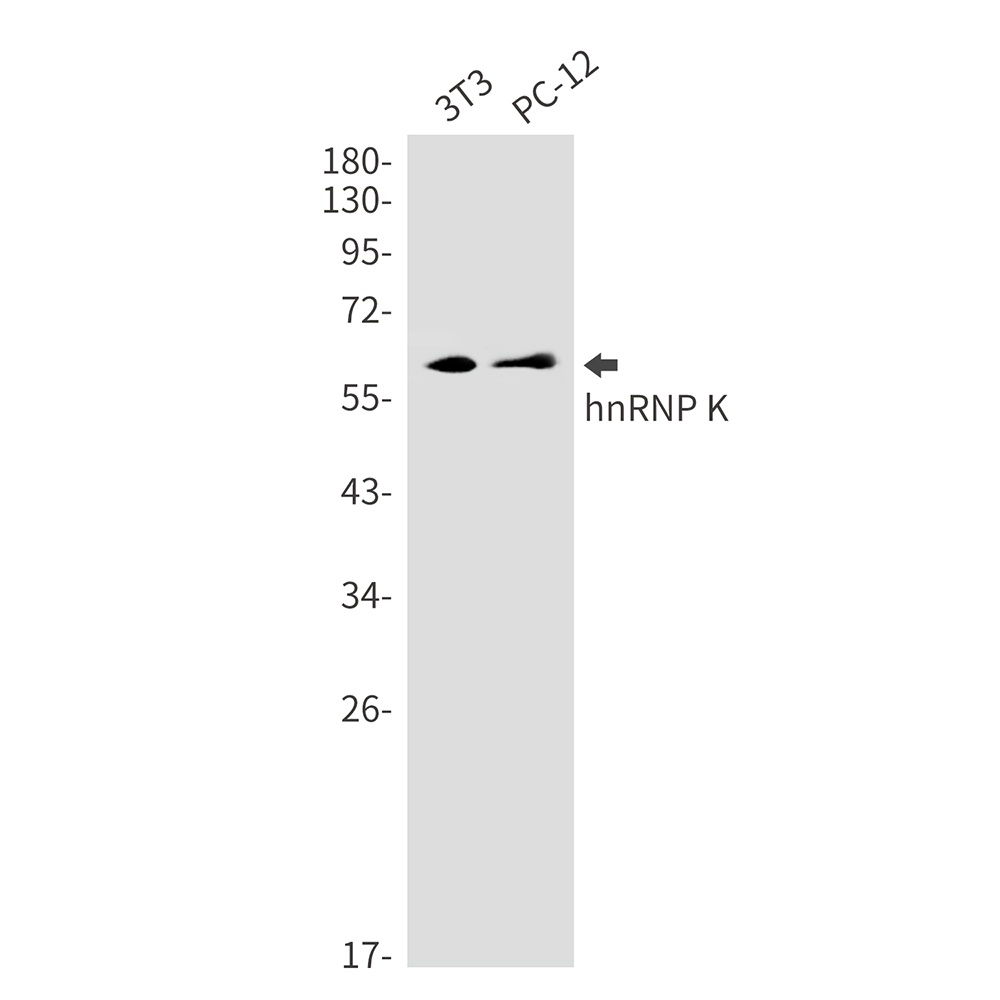 hnRNP K Rabbit mAb