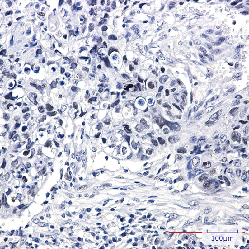 hnRNP K Rabbit mAb