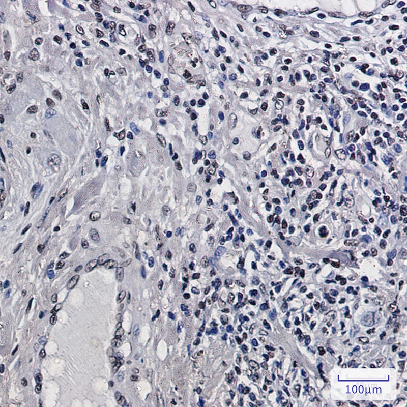 Histone H2B Rabbit mAb