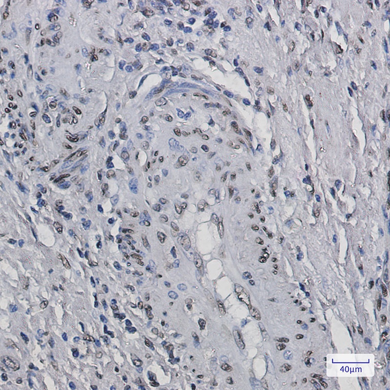 Histone H2B Rabbit mAb