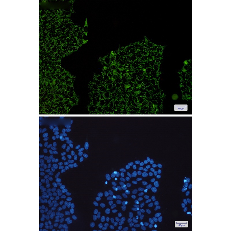 HADHA Antibody