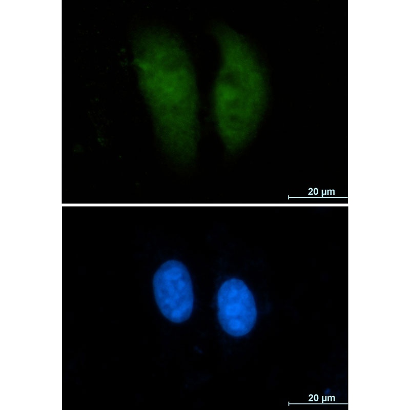 GSTP1 Antibody