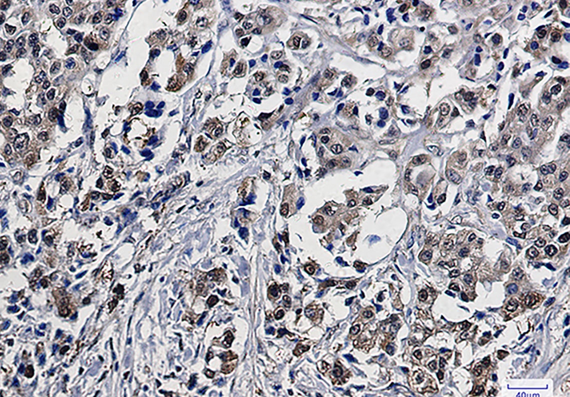 GSTP1 Antibody