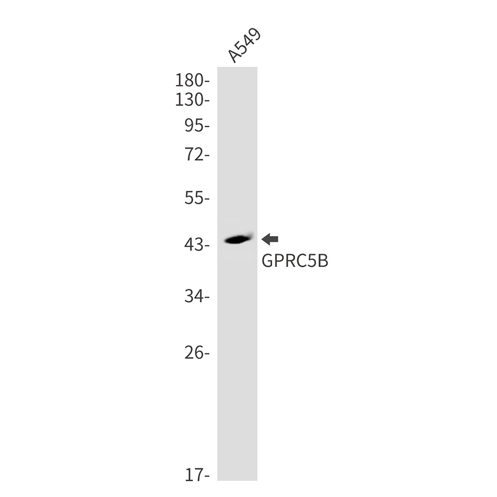 GPRC5B Rabbit mAb