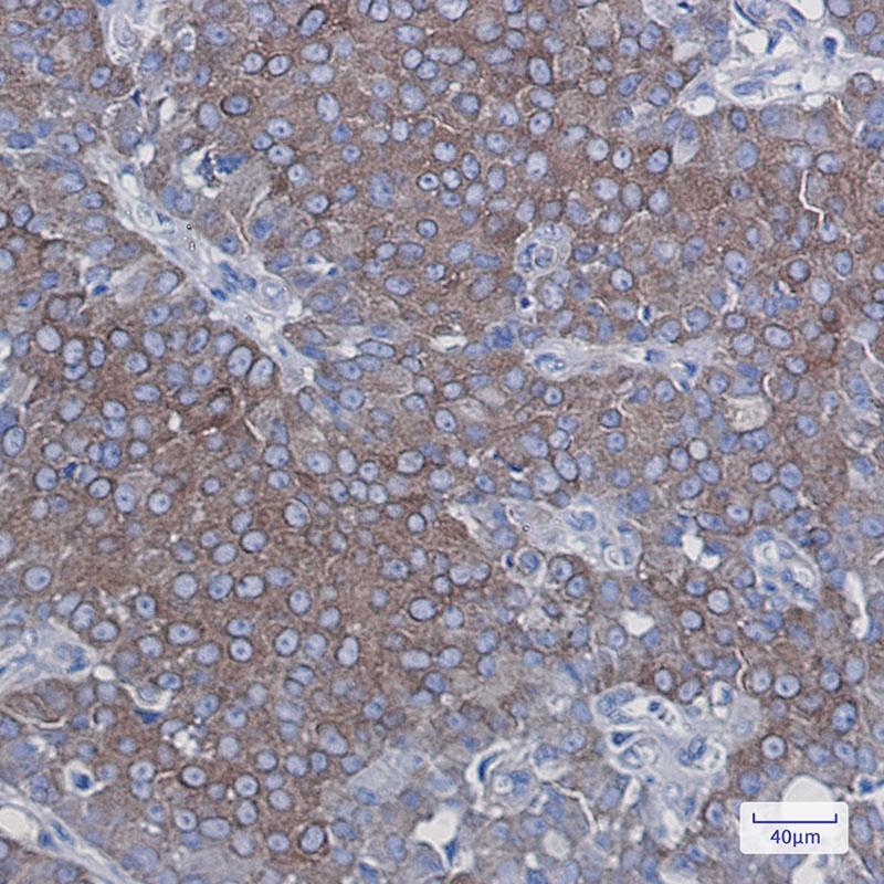 LGR6 Antibody
