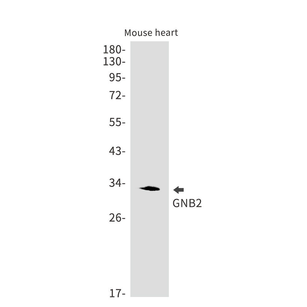 GNB2 Rabbit mAb