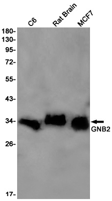 GNB2 Rabbit mAb