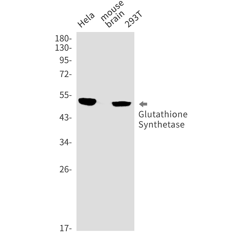 Glutathione Synthetase Rabbit Monoclonal Antibody