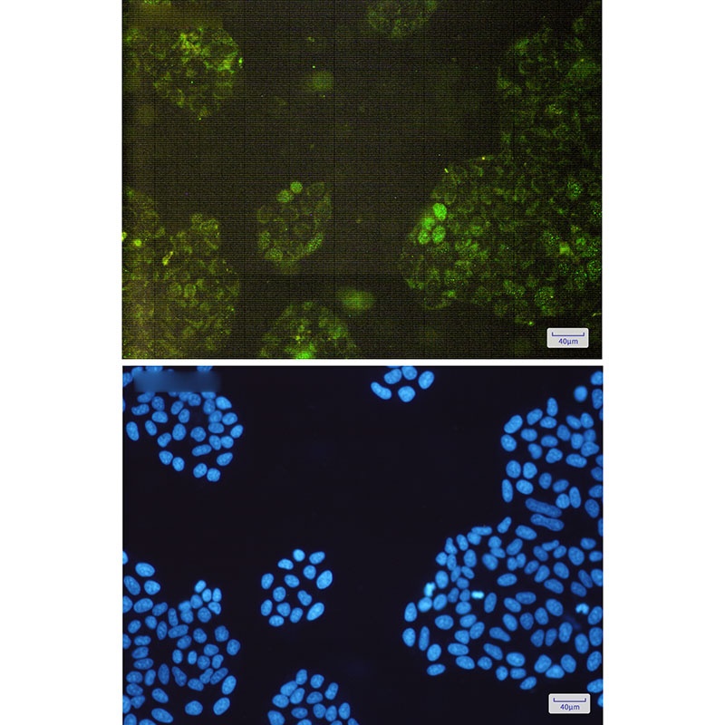 GSTK1 Rabbit mAb