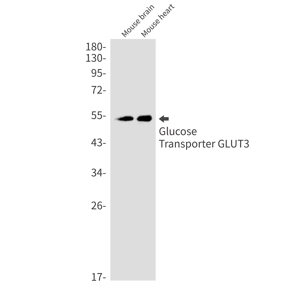 Glucose Transporter GLUT3 Rabbit mAb