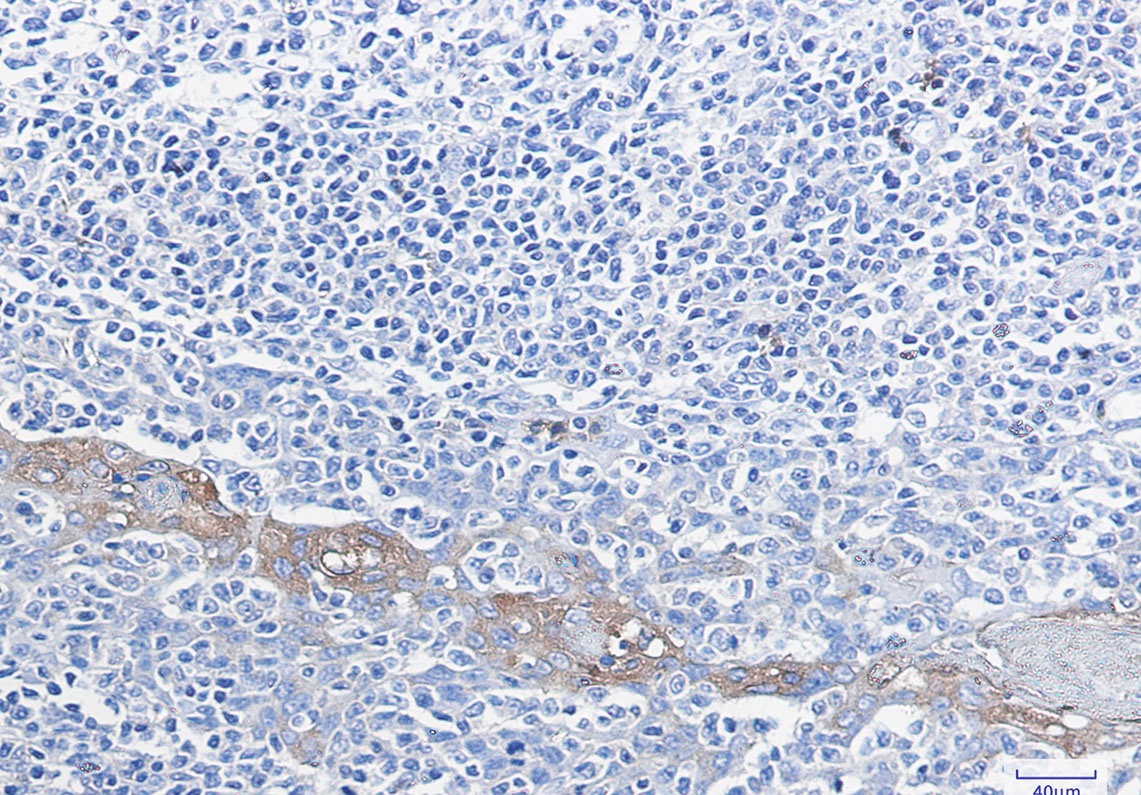 G6PD Antibody
