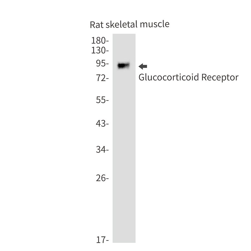 Nr3C1 Antibody