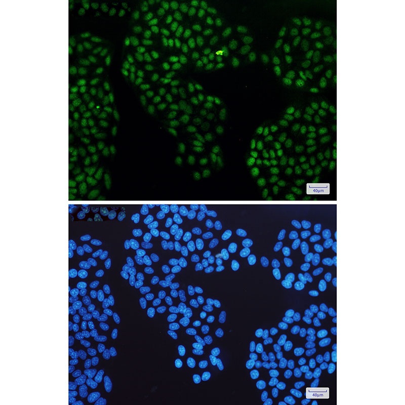 Nr3C1 Antibody