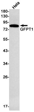 GFPT1 Rabbit mAb