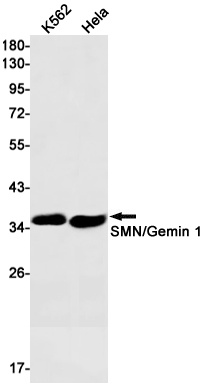 SMN Rabbit mAb