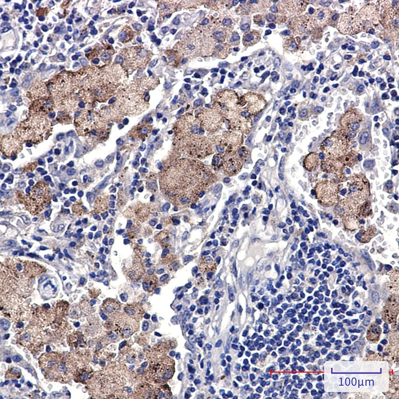 SMN Rabbit mAb