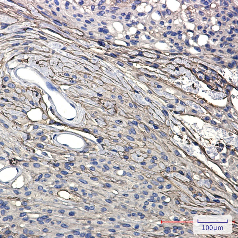 GAP43 Rabbit mAb
