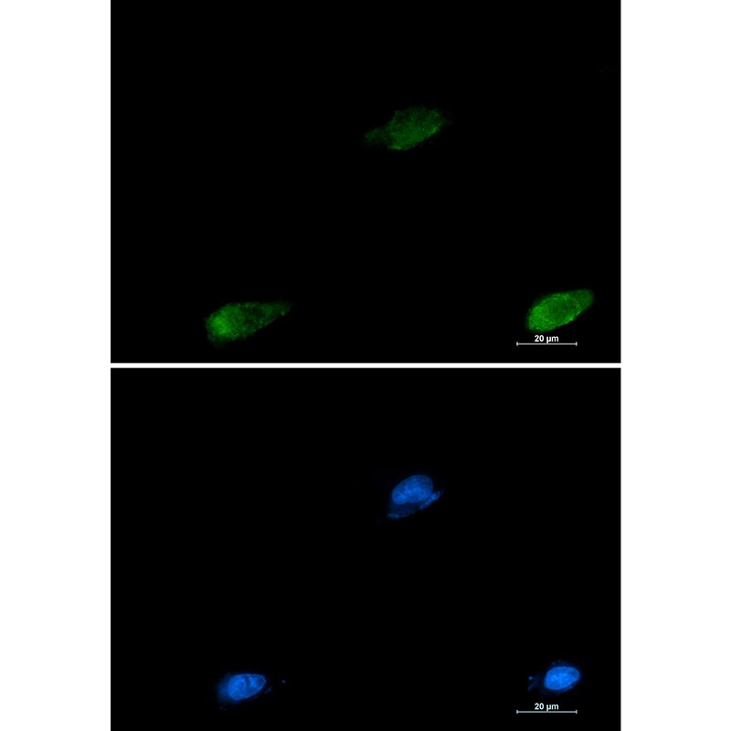 Galectin 3 Rabbit mAb