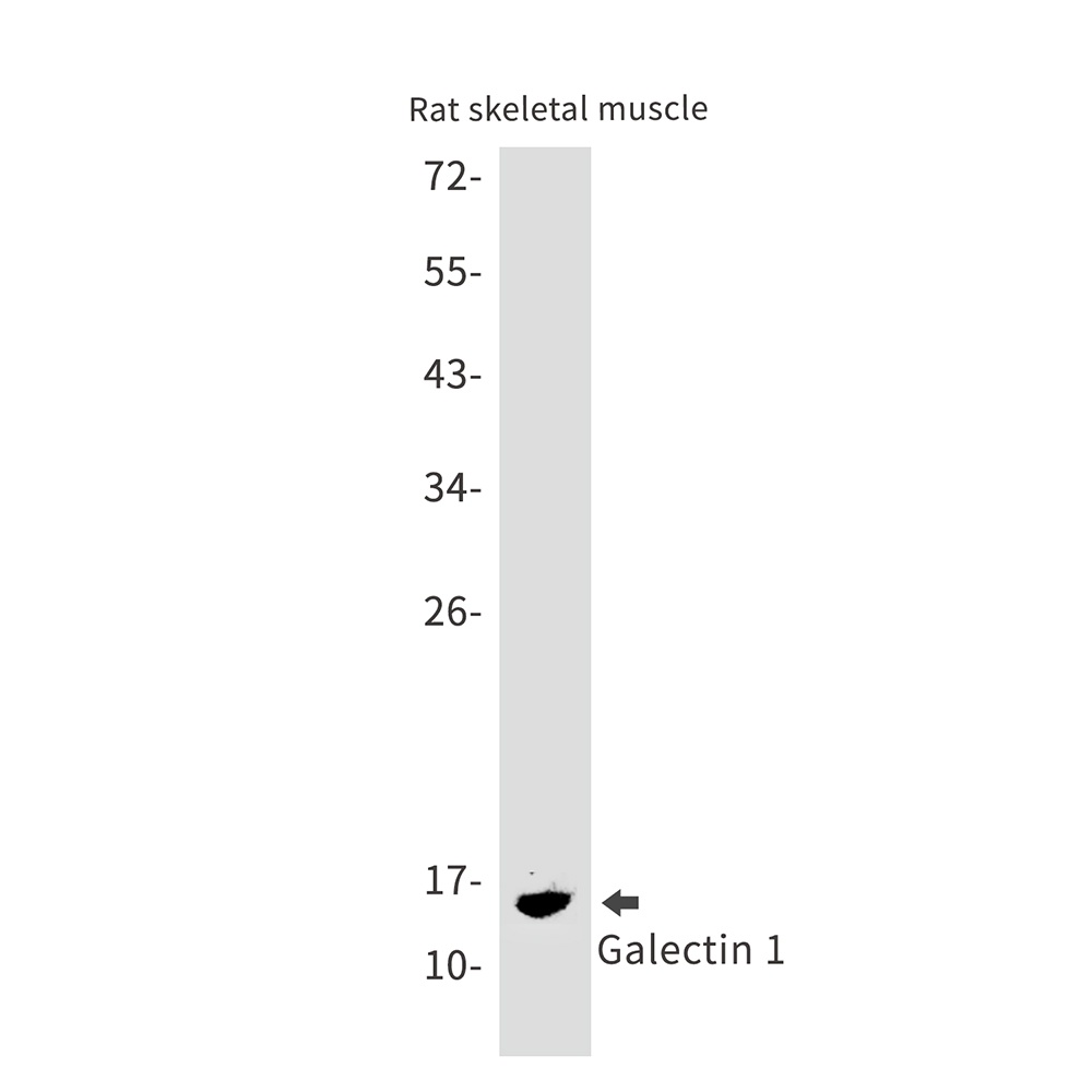 LGALS1 Antibody