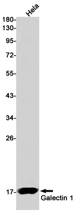 LGALS1 Antibody