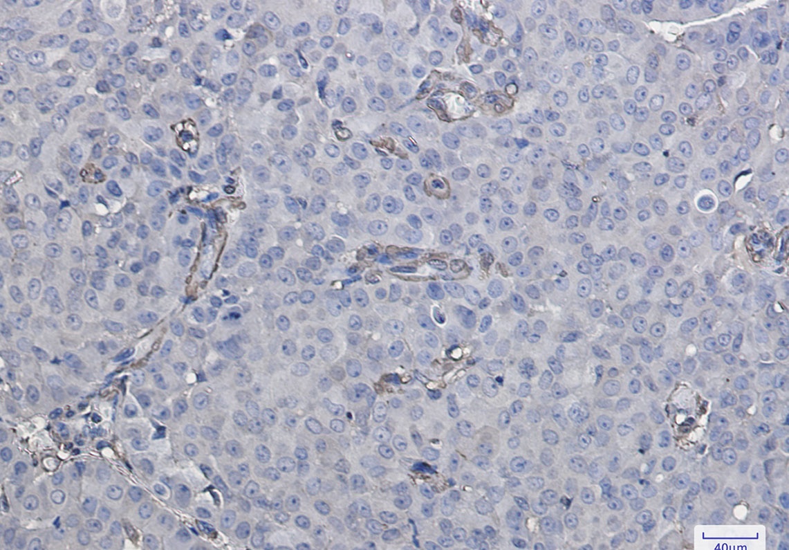 LGALS1 Antibody