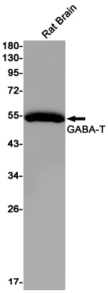 ABAT Antibody