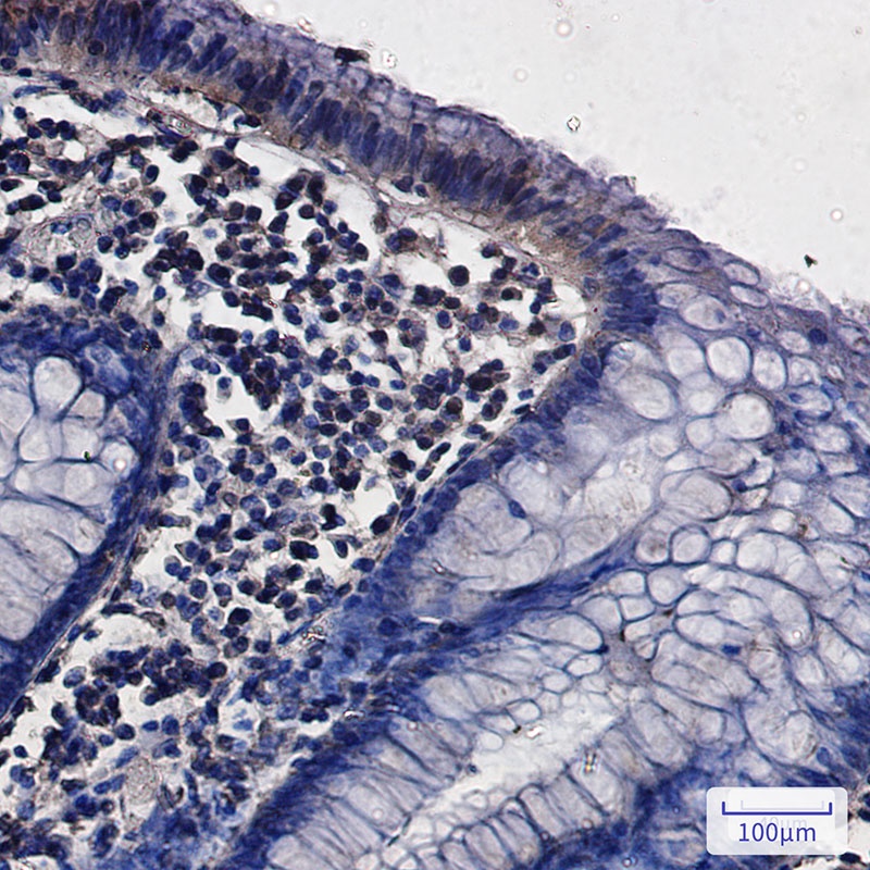 [KD] G3BP Rabbit mAb