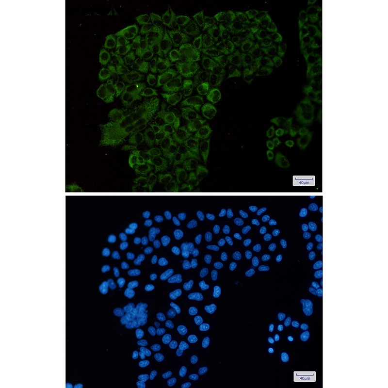[KD] G3BP Rabbit mAb