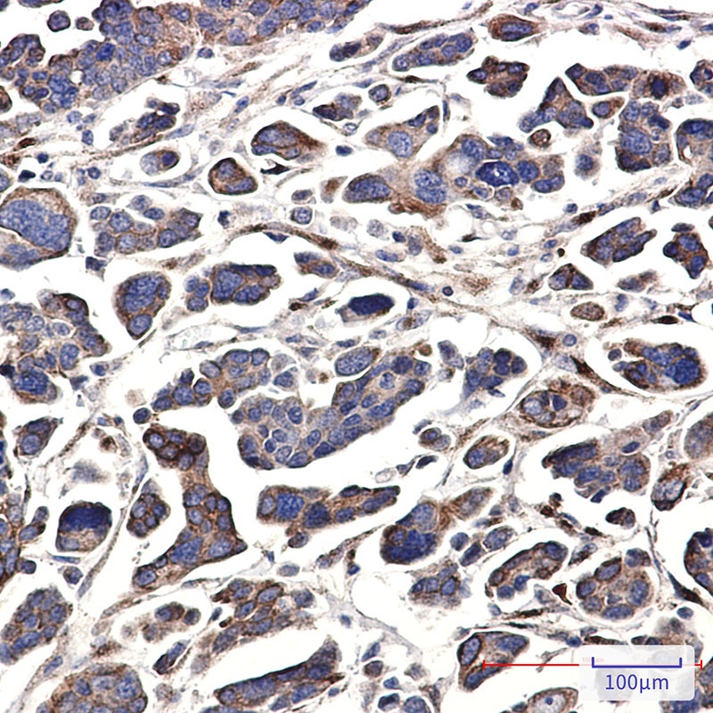 GNA13 Rabbit mAb
