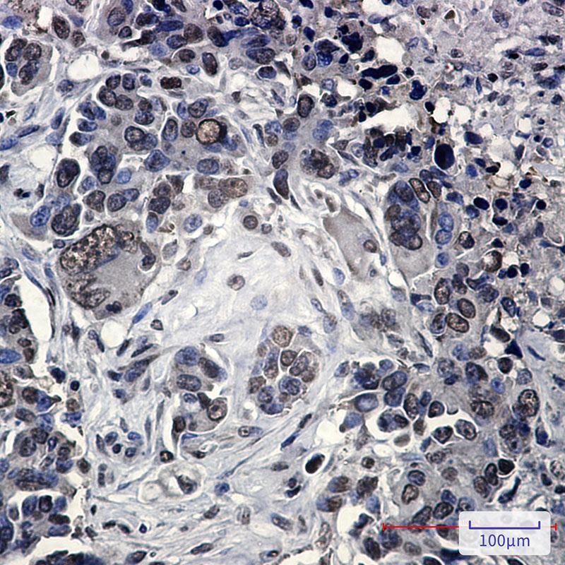 FUBP1 Rabbit mAb