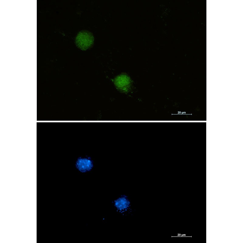 FUBP1 Rabbit mAb