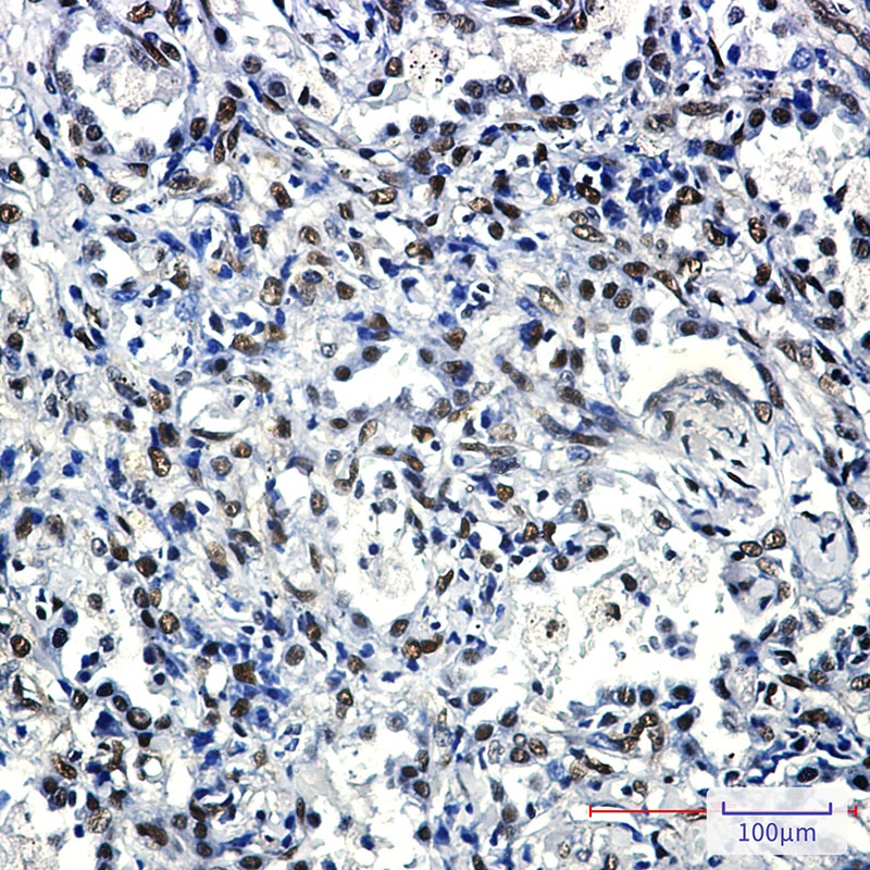 FTO Rabbit mAb