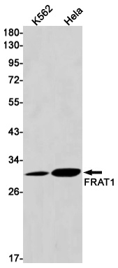 FRAT1 Rabbit mAb