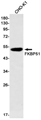 FKBP51 Rabbit mAb