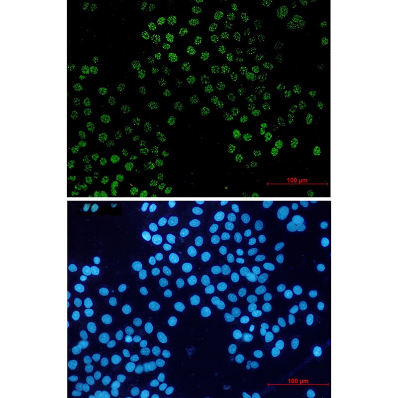 FAM50A Antibody