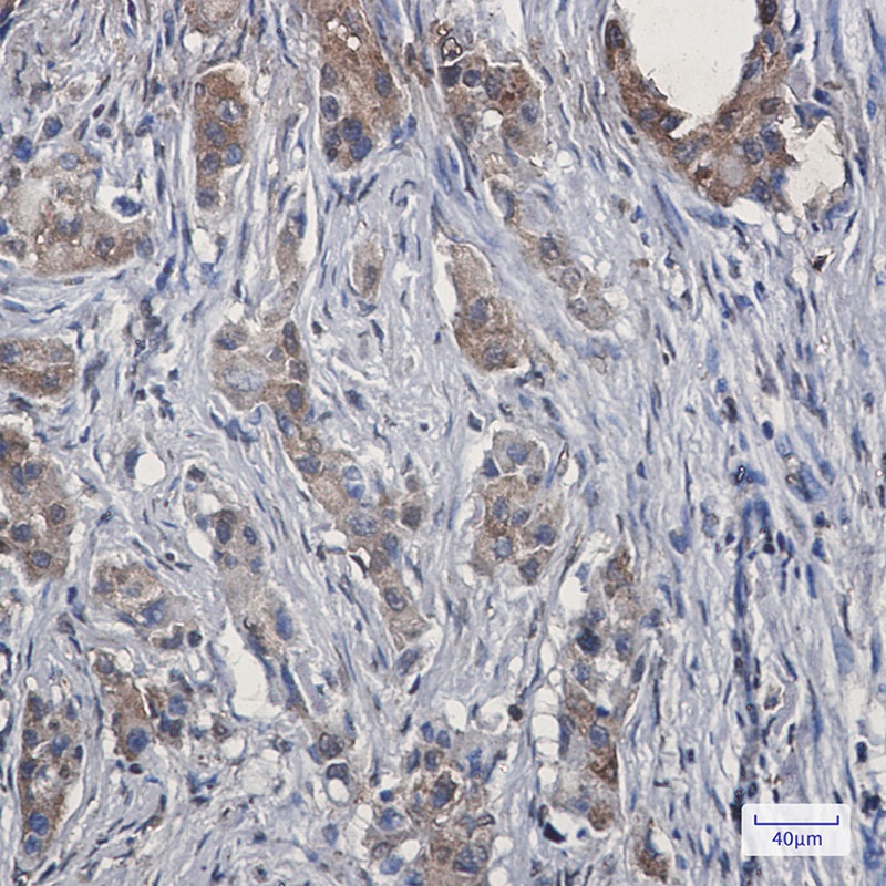EZR Antibody