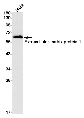 Extracellular Matrix Protein 1 Rabbit mAb