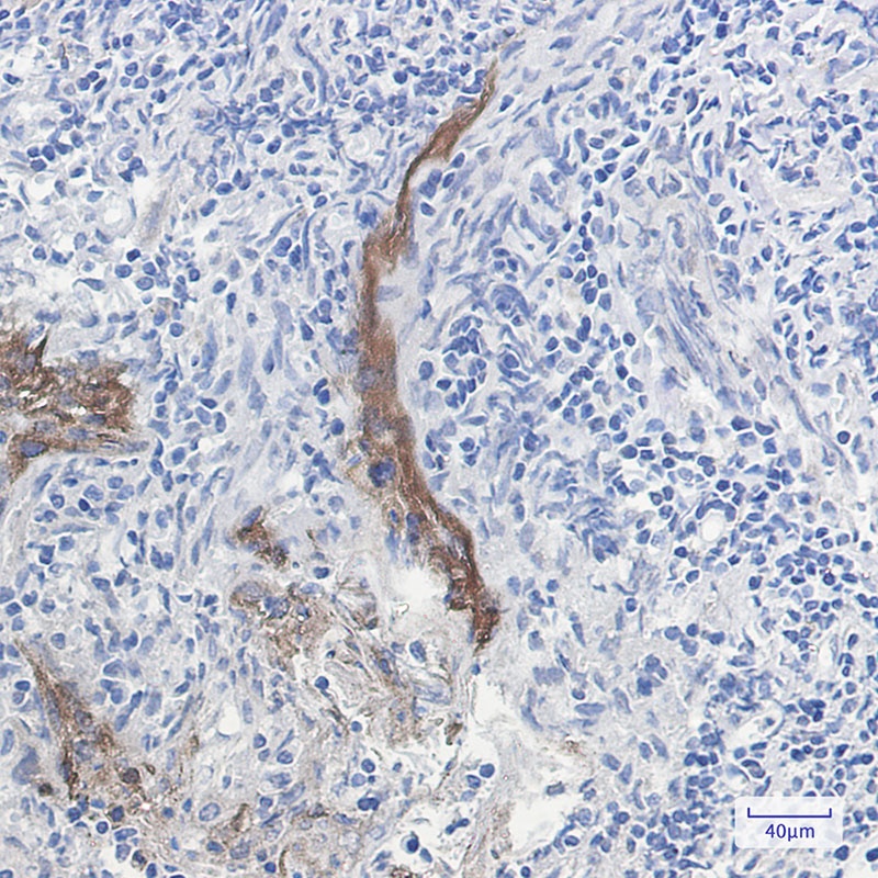 Extracellular Matrix Protein 1 Rabbit mAb