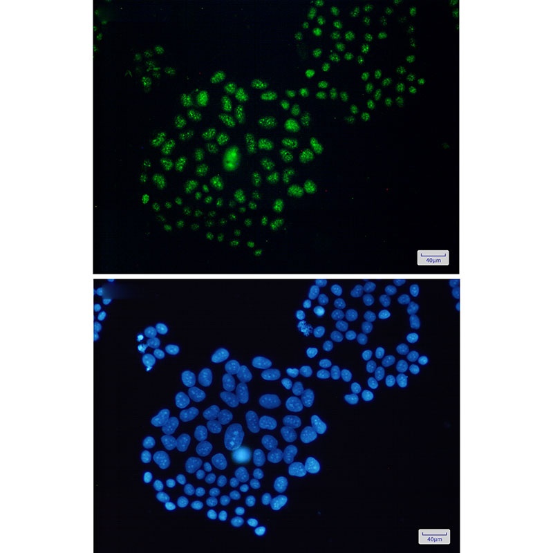 EWSR1 Antibody