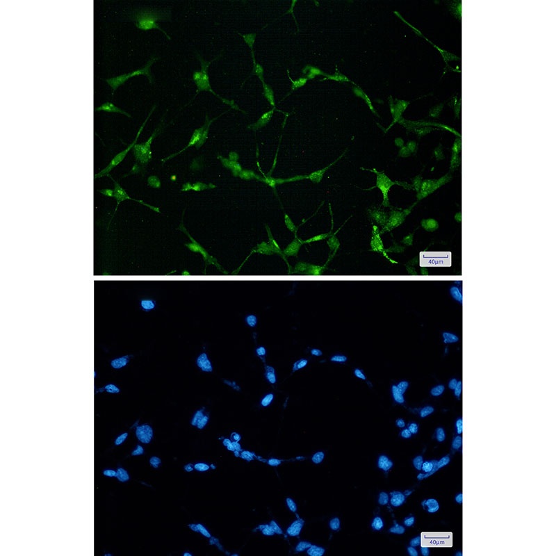 EWSR1 Antibody