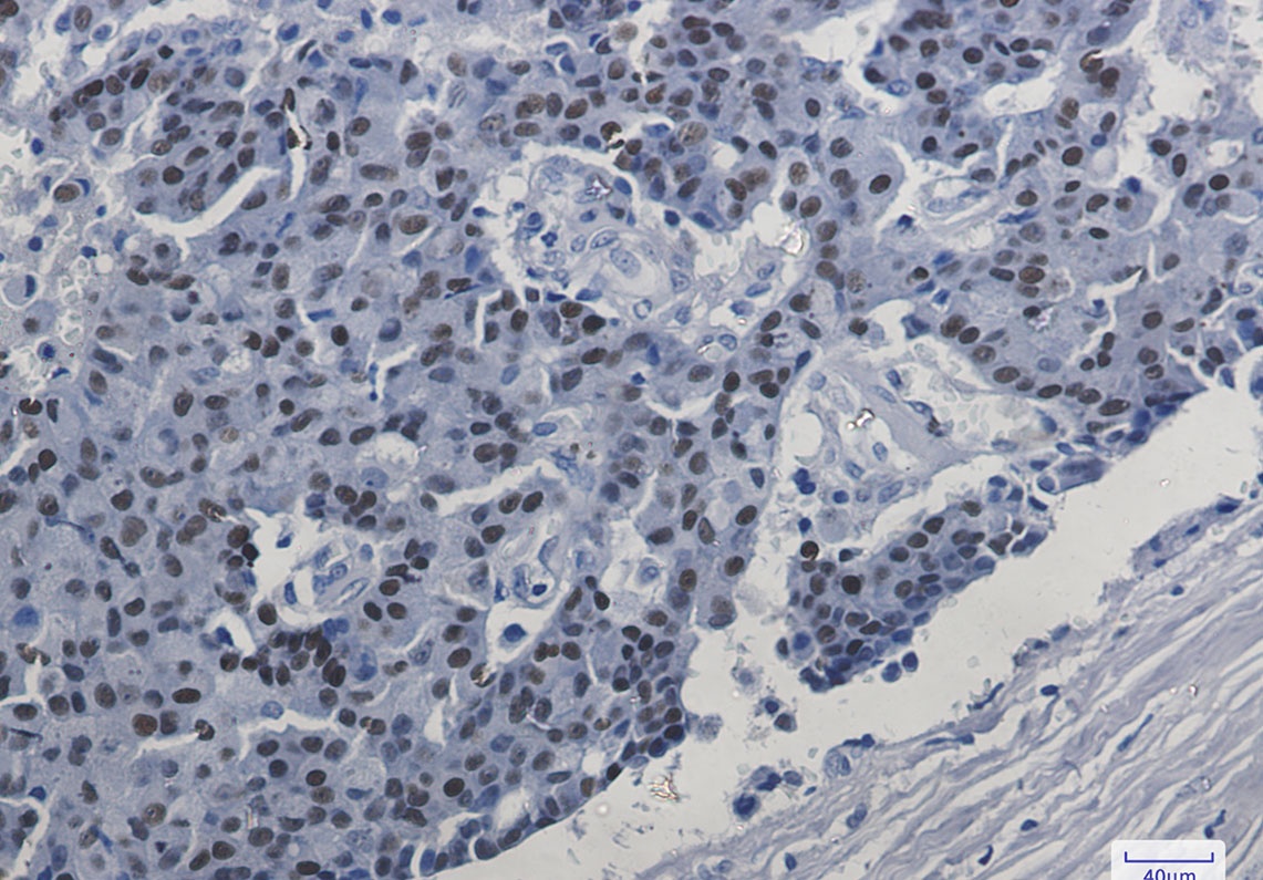 ESR1 Antibody