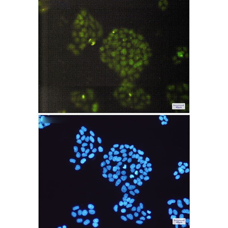 ERCC1 Antibody
