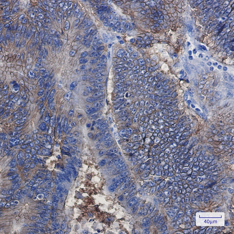 EPCAM Antibody