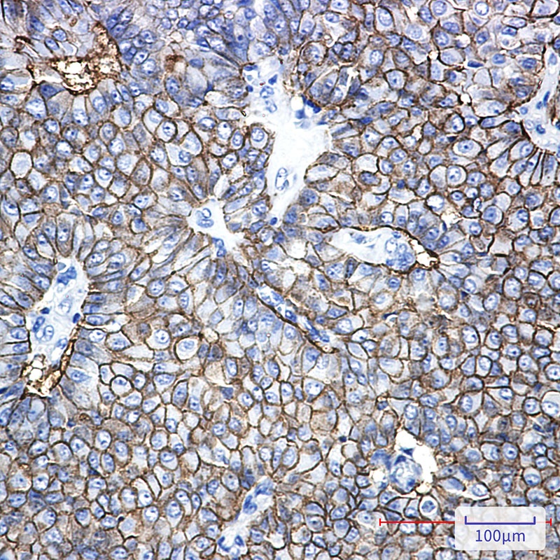EPCAM Antibody