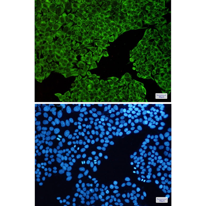 ENO3 Antibody