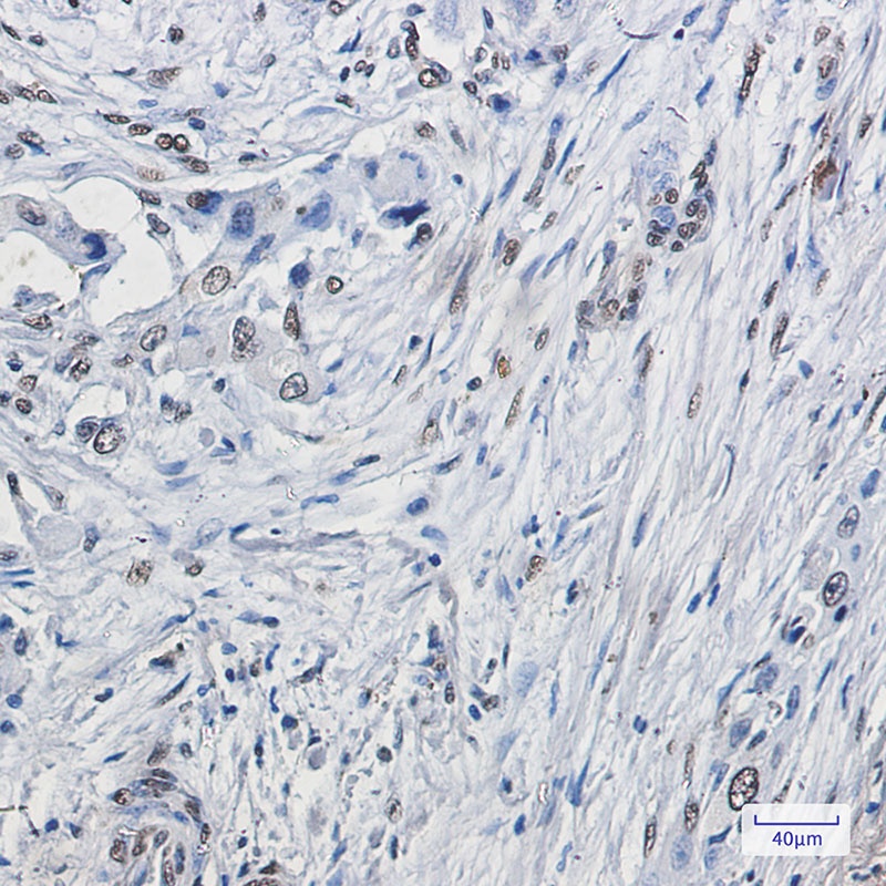 ELK1 Rabbit mAb
