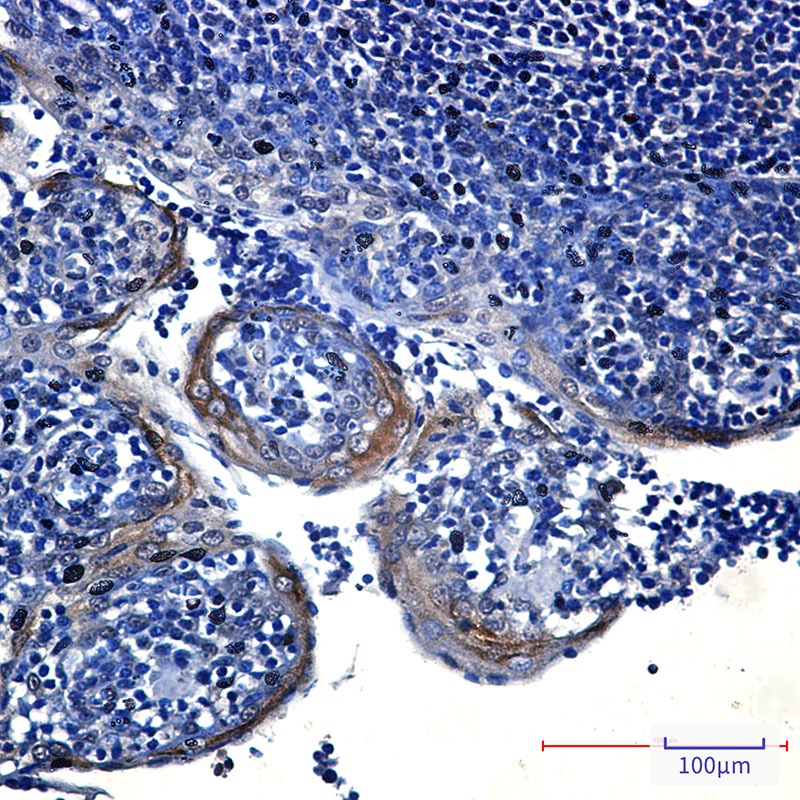 EIF4A3 Antibody