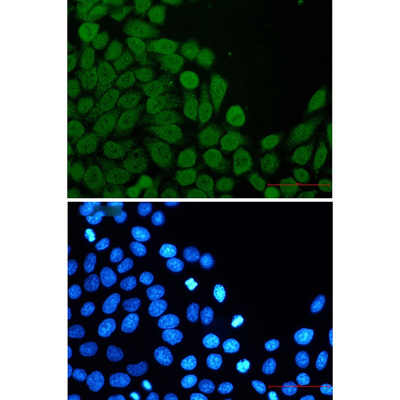 EIF4A3 Antibody