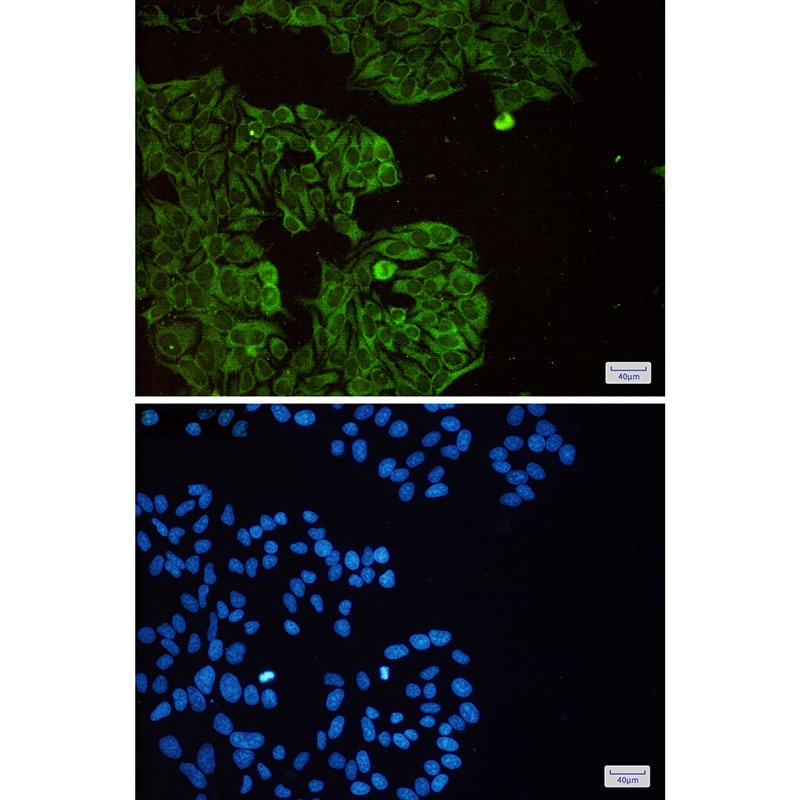 EIF3B Antibody